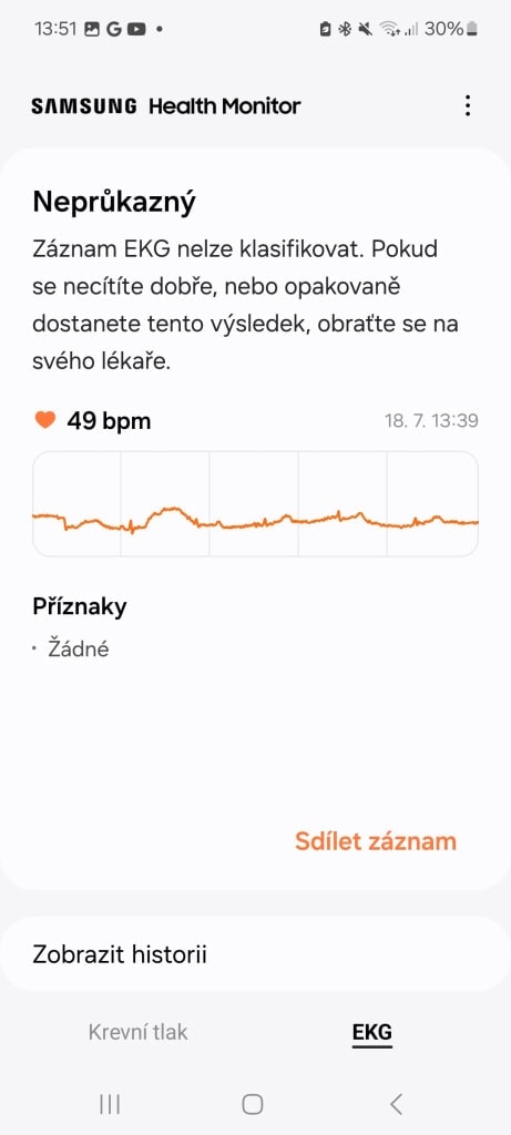 Rejestrowanie pomiarów EKG