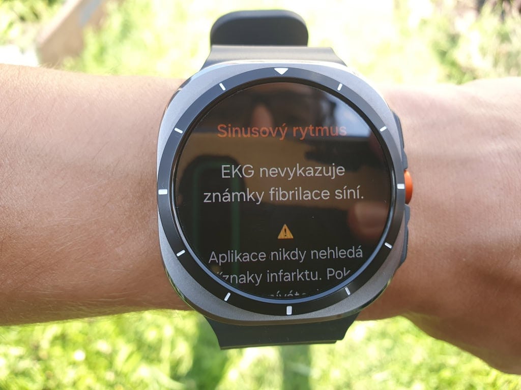 EKG w zegarku jest przeznaczone wyłącznie do wykrywania migotania przedsionków