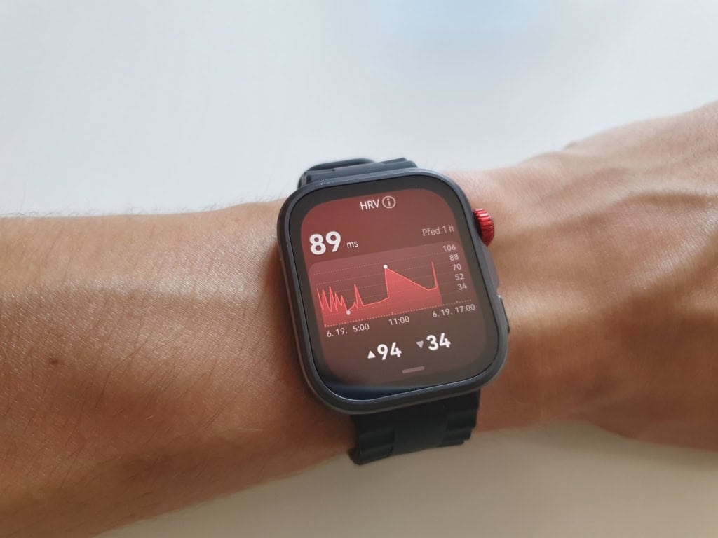 Wariabilność tętna